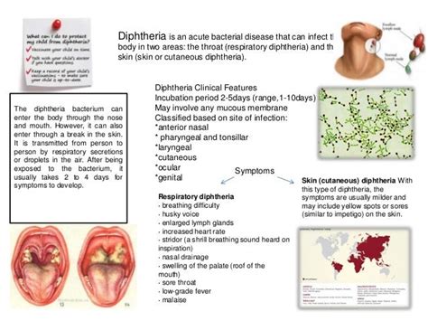 Diphtheria