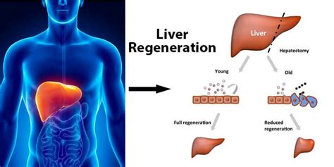 Liver Regeneration