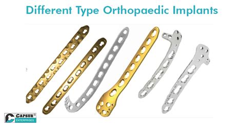 6 Different Types of Orthopaedic Implants and Their Insistent Demand in ...