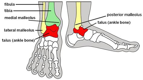 Pilon fracture (also called a plafond fracture): This is a fracture through the weightbearing ...