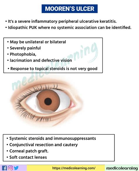 Mooren’s Ulcer – MedicoLearning