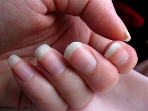 What's Up With That: Your Fingernails Grow Way Faster Than Your Toenails | WIRED