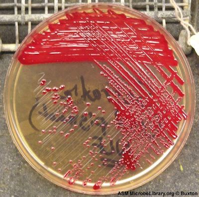 Random Thoughts from a Fish: Its name is Serratia Marcescens