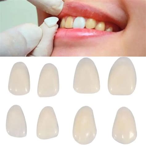 70pcs/pack Dental Temporary Crown Ultra Thin Resin Whitening Teeth Anterior Shade Tooth Veneers ...