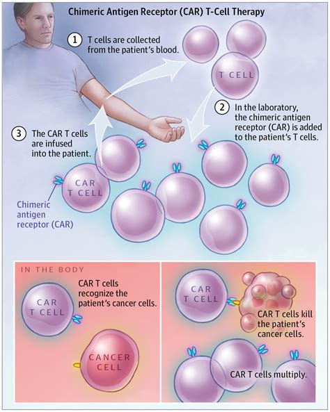 Chimeric Antigen Receptor (CAR) T-Cell Therapy | Oncology | JAMA Oncology | JAMA Network