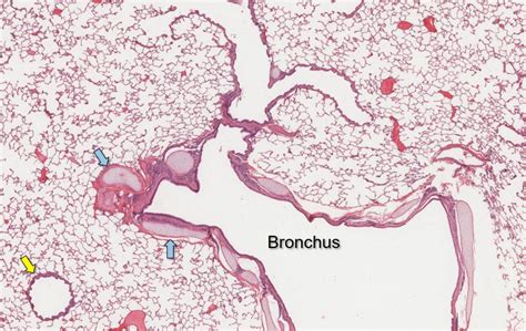 Terminal Bronchiole Histology