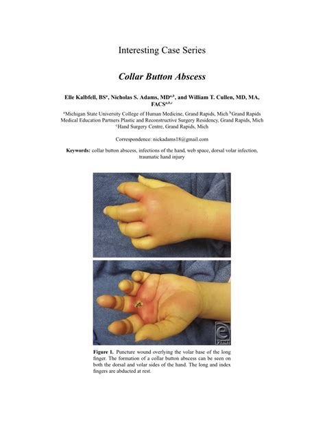 (PDF) Collar Button Abscess