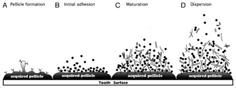 Dental Biofilm/Plague Gone Bad!