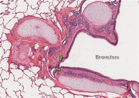 Air conduction: Larynx, Trachea, Bronchi and Bronchioles – Veterinary Histology