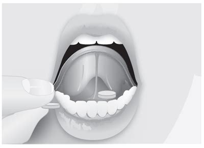 These highlights do not include all the information needed to use BUPRENORPHINE SUBLINGUAL ...