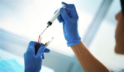 Blood Test Procedure Stock Photo - Download Image Now - iStock