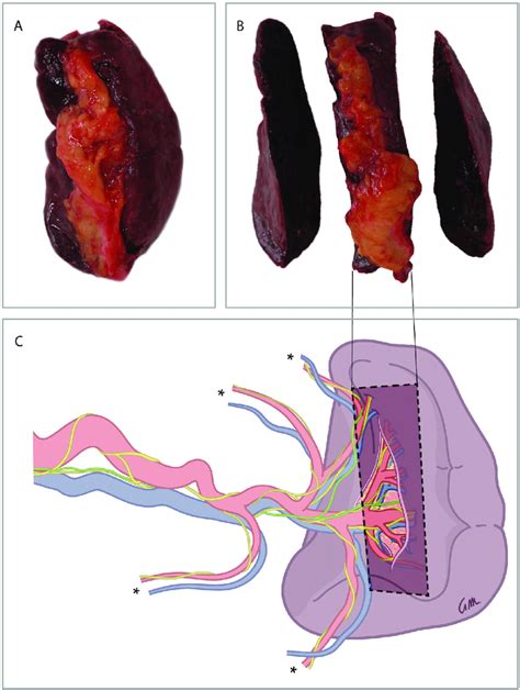 Isolation of the spleen hilum for histological analysis. The main goal ...