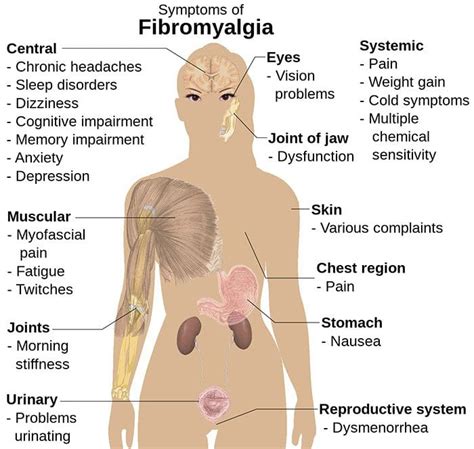 Fibromyalgia Syndrome: Diagnosis And Treatment | EP Wellness Clinic