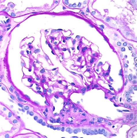 Juxtaglomerular Apparatus Histology