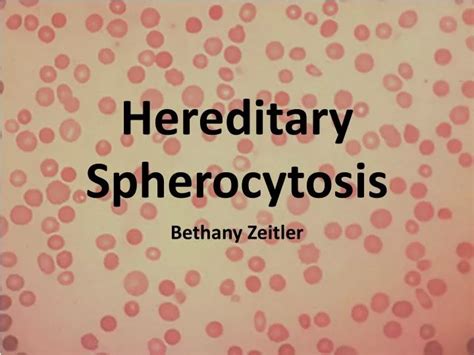 PPT - Hereditary Spherocytosis PowerPoint Presentation - ID:2117076