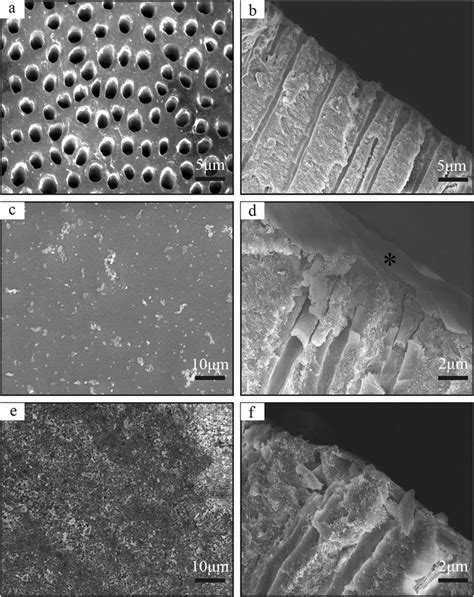 SEM photographs showing the morphologies of the exposed dentinal ...