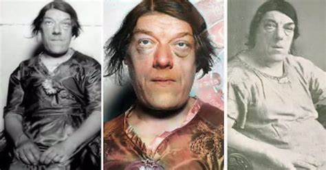 Mary Ann Bevan - The World's Ugliest Woman | ThatViralFeed