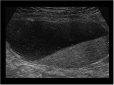 Abdomen and retroperitoneum | 1.11 Abdominal wall : Case 1.11.2 ...