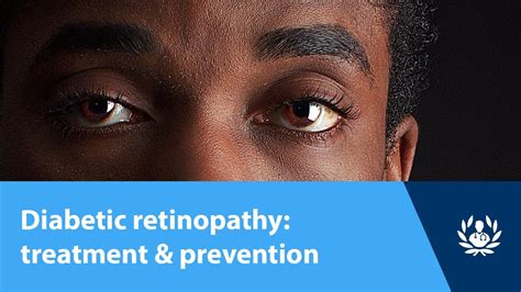 Diabetic retinopathy: treatment & prevention - Diabetes