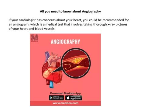 PPT - Types of heart Disease Angiogram PowerPoint Presentation, free download - ID:10558159