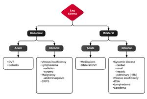 Bilateral leg swelling - WikEM