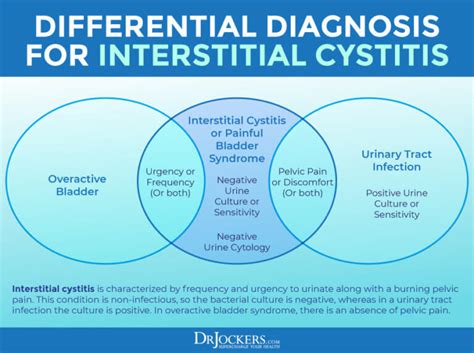 Interstitial Cystitis: Symptoms, Causes and Support Strategies