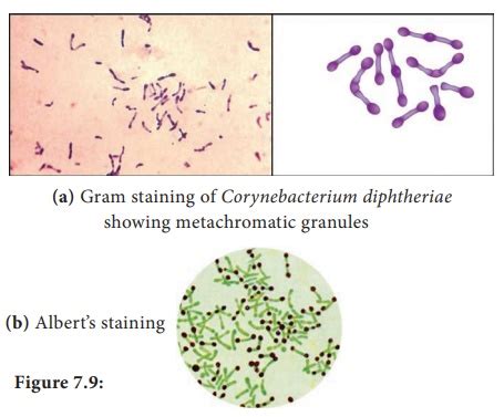 Corynebacterium Diphtheriae - Morphology, Cultural Characteristics ...