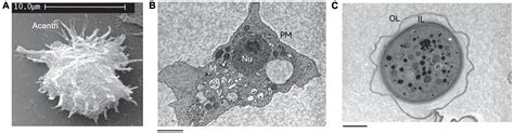 Acanthamoeba Trophozoite