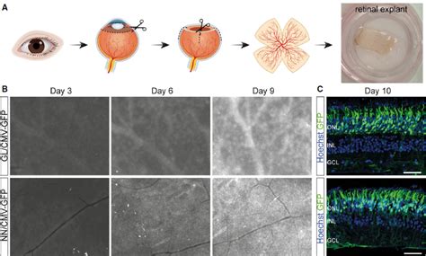 A new breakthrough in gene therapy for eye diseases - Medical News