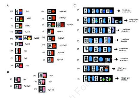 Illustration of the chromosome alterations on 5q (A), 7q (B) and 11q ...