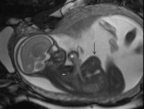 Do These Images Show MRIs of Fetuses? | Snopes.com