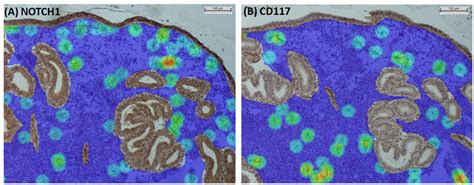 Density heat maps of (A) NOTCH1+ cells and (B) CD117+ cells in the ...