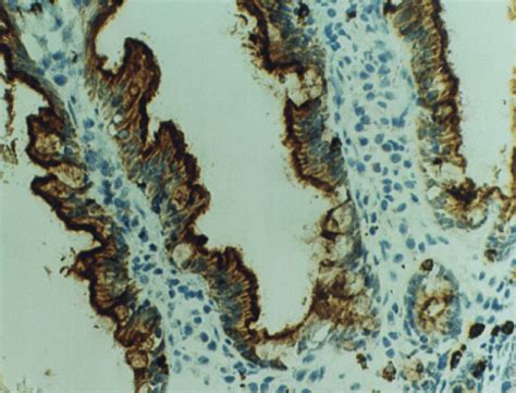 Lactase Persistence Cell Biology - EvoEd : EvoEd