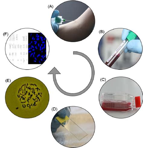 The cytogenetic analysis starts with culturing of a blood sample,... | Download Scientific Diagram