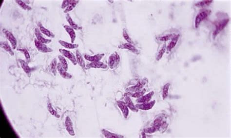 Toxoplasmosis - microbewiki