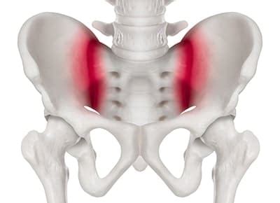 SI Sacroiliac Joint Injection - Spine & Orthopedic Center