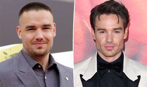 Liam Payne Before And After Jaw Transformation: A Detailed Analysis