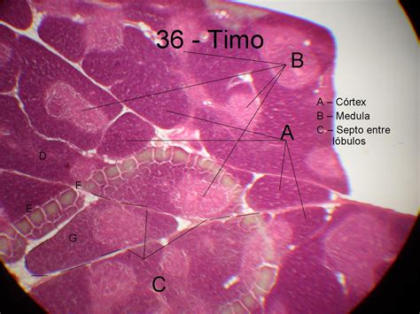 36. timo - Histologia I