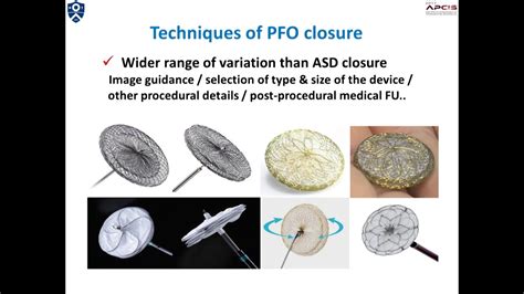 Introduction of PFO Closure - YouTube