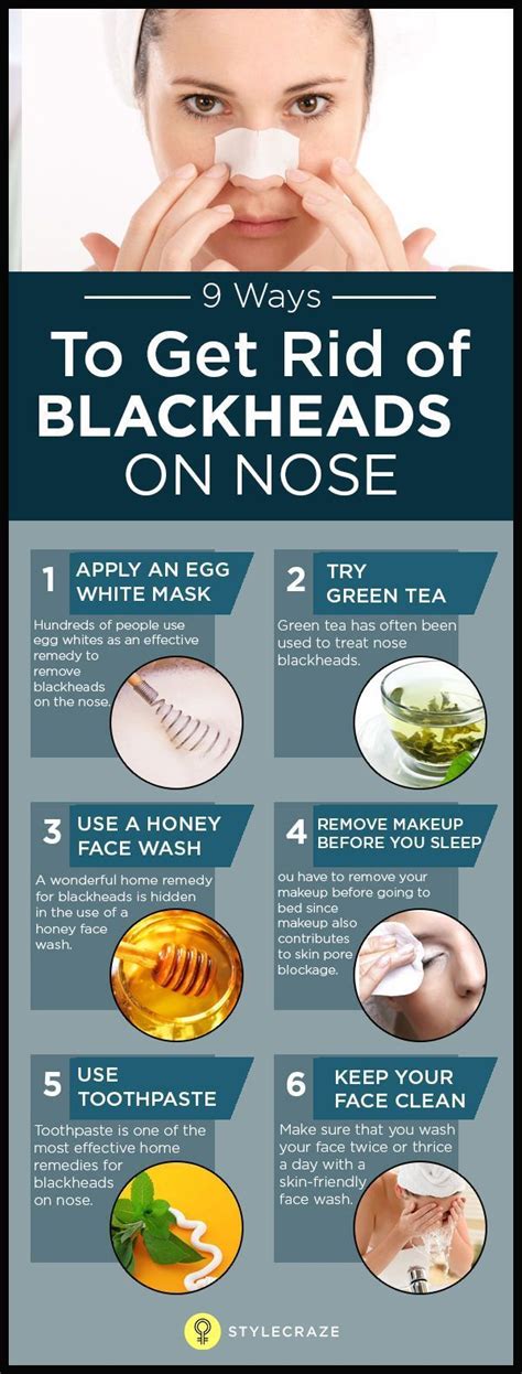 How To Remove Blackheads On Nose at Home Fast | Get rid of blackheads, Blackheads on nose ...