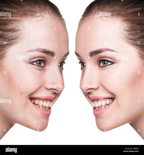 Young woman before and after retouch Stock Photo - Alamy