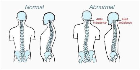 Welcome to Atlas Orthogonal Health - Home