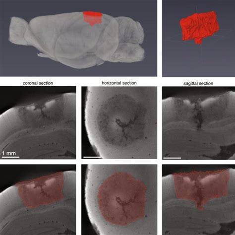 Visual cortex lesion characterization using micro-CT. (a) 3D... | Download Scientific Diagram