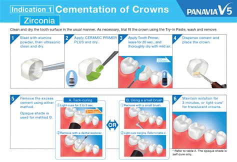 Zirconia Cement for Zirconia Crowns & Bridges Long Term Survival