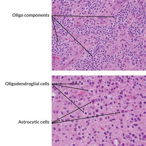 Pathology