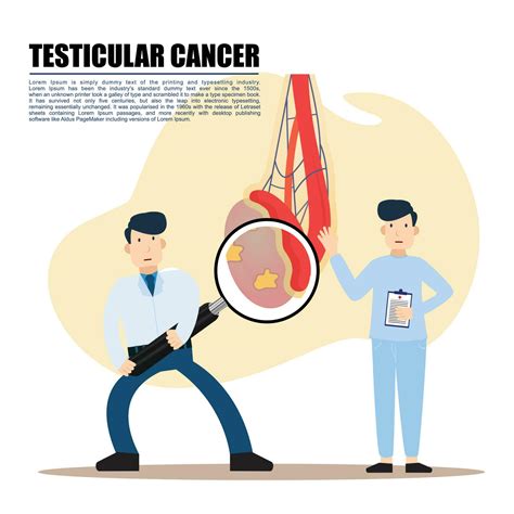 A Male Anatomy of Testicular Cancer 23959517 Vector Art at Vecteezy