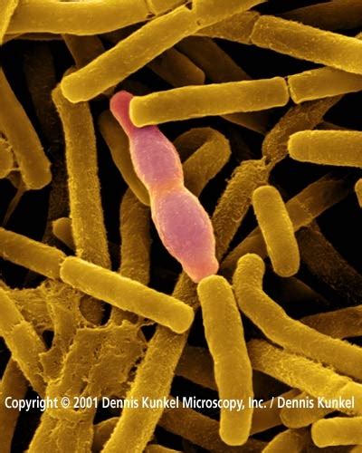 Bacillus anthracis. Causes, symptoms, treatment Bacillus anthracis