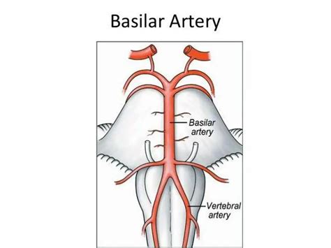 Pictures Of Basilar Artery