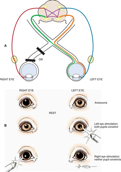 pupillary light reflex - DriverLayer Search Engine