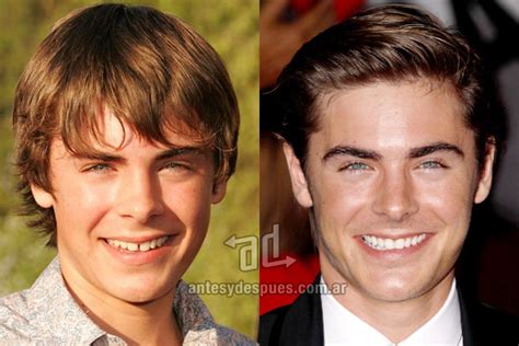 » 20 Best Celebrity Teeth |Before and After | Photos, Biography and Family